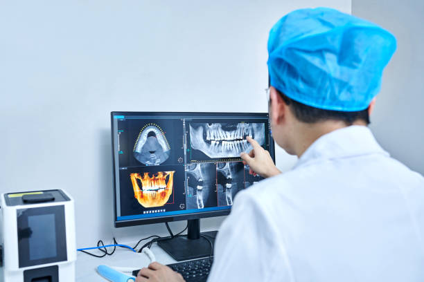 Best Teeth Whitening  in Chlicothe, IL